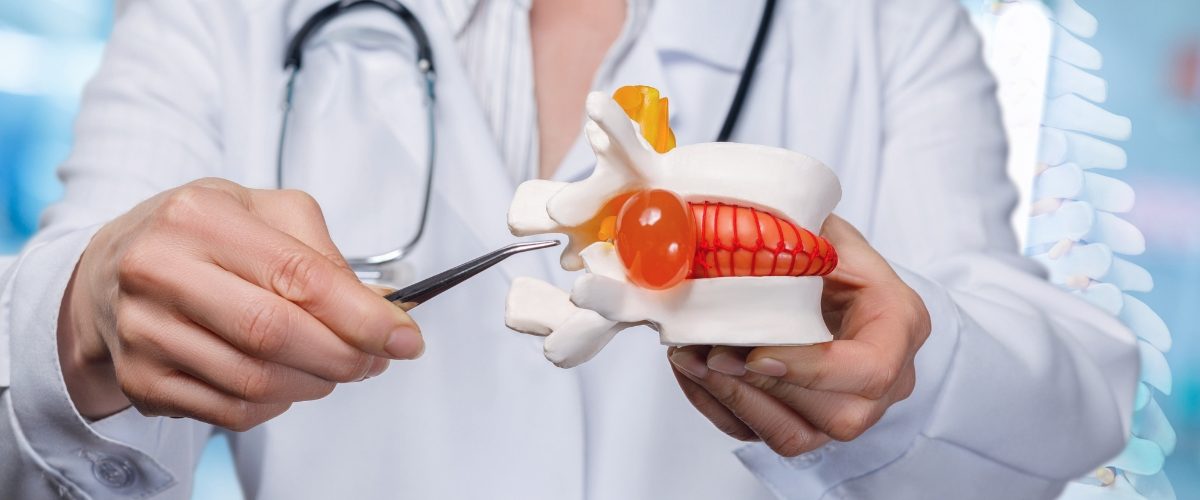Cirurgia de hérnia de disco é perigosa