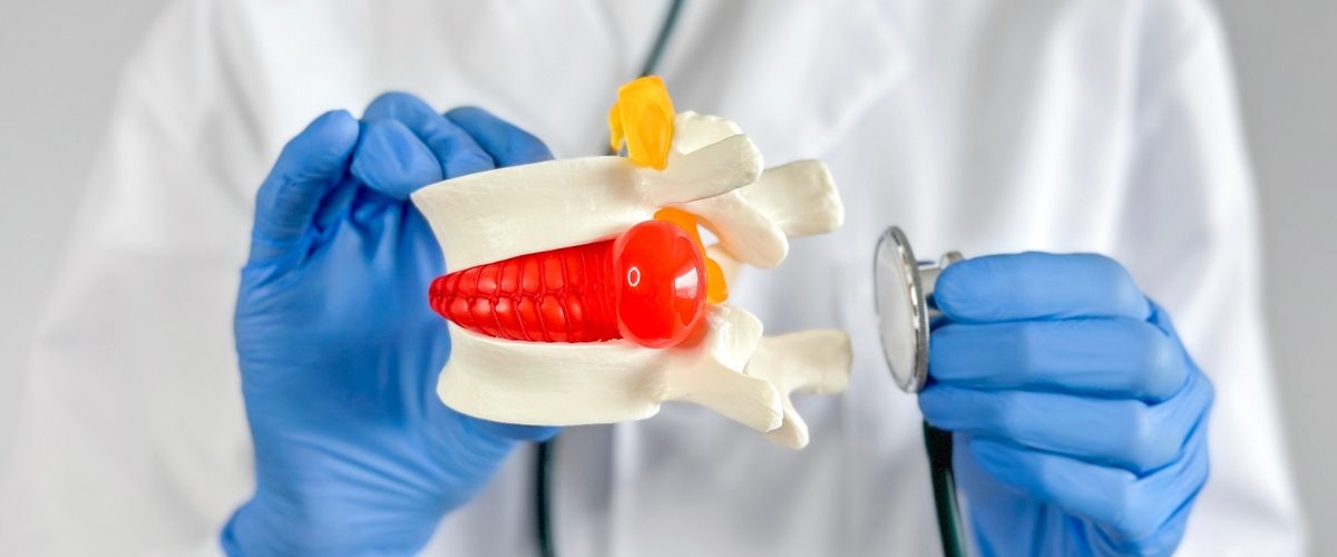 _especialista em hérnia de disco